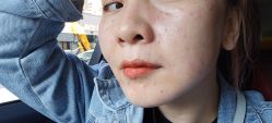 -亿美医疗美容·半岛大超炮官方授权店