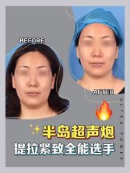-联合丽格·张菡丽格医疗美容