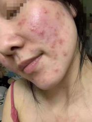 -VE专注问题肌·赛诺龙&科学美肤中心