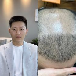 -型男帮男士假发补发·佩戴式发型