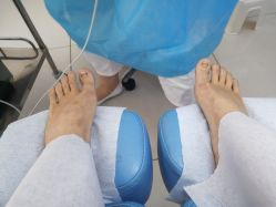 -派恩宜灰指甲鸡眼嵌甲手足癣