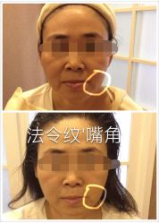 -苗方清颜专业祛痘