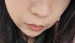 -广州健丽·去眼袋医疗美容机构