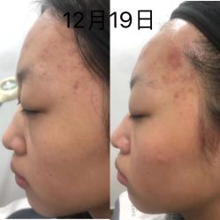 -黎蓓露·徒手骨雕蛋白抗衰·调肤管理