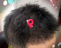 -大麦微针植发全国连锁