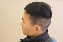 -大麦微针植发丨全国连锁