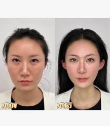 -上海伊莱美医疗美容医院
