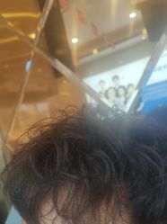 -碧莲盛·不剃发植发