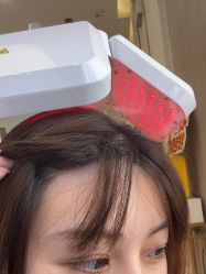 -大麦微针植发全国连锁