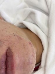 -蕾特恩专业祛痘·皮肤管理