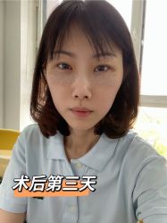 点击看大图 体验后-天津时光诺颜·轻医美·轮廓抗衰中心