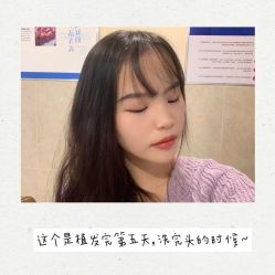 -碧莲盛·不剃发植发