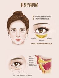 -广州健丽·去眼袋医疗美容机构