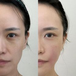 -Yestar艺星医疗美容医院