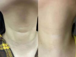 -上海漾颜医疗美容