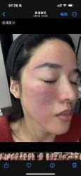 点击看大图 -深圳鹏爱秀琪医疗美容医院
