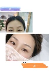点击看大图 -Verywang半永久纹眉•仪器野生眉