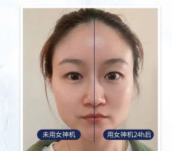 -东森自然美.INDIBA.美容SPA.皮肤管理