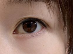 -洁铭新加坡医美