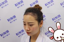 -大麦微针植发丨全国连锁