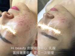 -Hi Beauty Skin 科技美肤中心