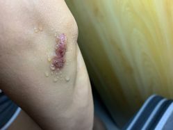 体验前-重庆军科整形美容医院