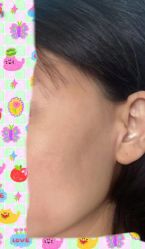 -纯粹医美