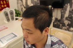 点击看大图 -大麦微针植发丨全国连锁