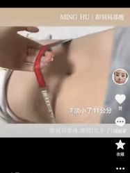 点击看大图 -星港国际·Skin皮肤专研·皮肤管理