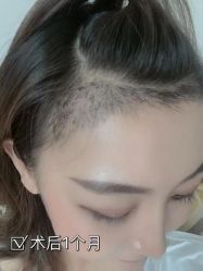 -雍禾植发全国连锁