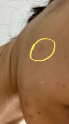 -南宁华美医疗美容医院