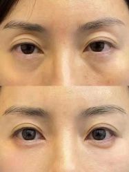 -Yestar 嘉兴艺星医疗美容医院