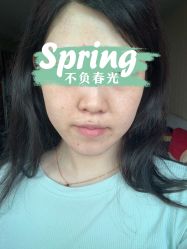 体验后-北京米扬丽格医疗美容·联合丽格鼻整形中心