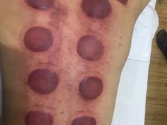 -传古推拿·古法按摩(义井路店)