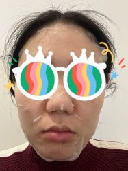体验后-纯粹医美