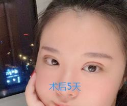 -成都西区医院整形美容