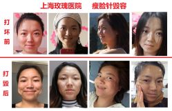 -上海玫瑰医疗美容医院