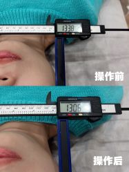 -颜和骨正·明哲式骨相美学整骨