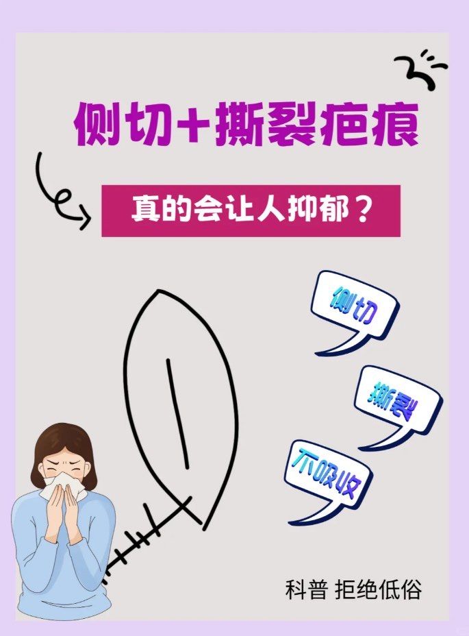 科普:顺产后侧切有疤痕还发痒怎么办?