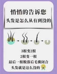 -润复丝·泽发防脱头皮管理