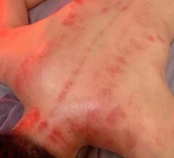 -香薇妮丝女子减肥院