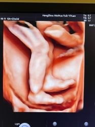 -杭州贝瑞斯美华妇儿医院·早孕·产检·儿科