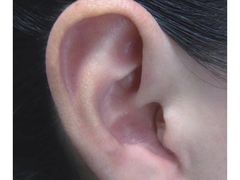 -惠耳听力助听器(奉贤南桥店)