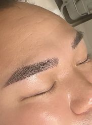 点击看大图 -诺恩Skin·科技美肤