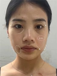 -上海伊莱美医疗美容医院