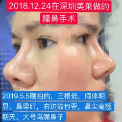 -深圳美莱医疗美容医院