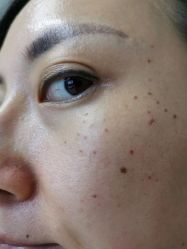 -铂诗玥医美