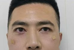 -天津健丽·去眼袋医疗美容机构
