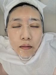 体验后-Dr.U博士医疗美容医院