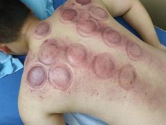 -郑远元专业修脚房(番禺路店)